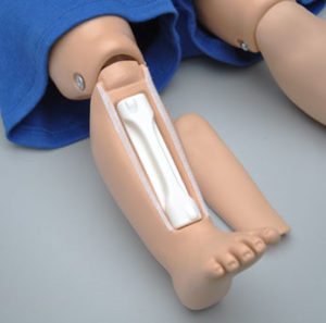 Infusão Intraóssea