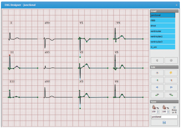 Interface do software mostrando eletrocardiograma