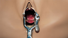 Orgão genital feminino com pinça genital