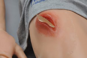 Ferimento WK120 na parte superior na coxa direita