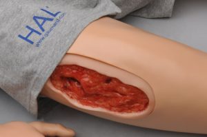 Ferimento WK120 na parte exterior na coxa direita