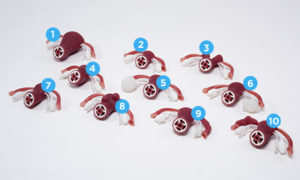 Úteros com patologias anormais externamente palpáveis