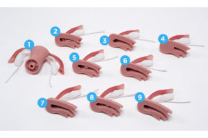 Útero com patologias internas normais e anormais